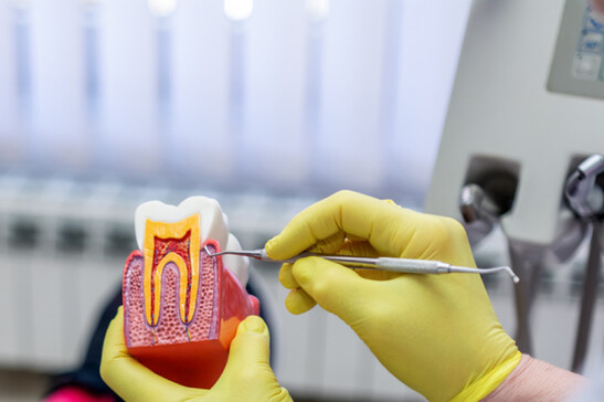  Dentista che spiega l'aspetto della cavità dentale. Paradontite denti Foto: bluecinema - iStock