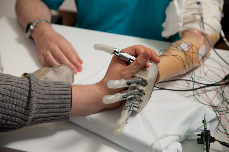 le protesi delle mani dialogano con gli arti fantasma senza usare elettrodi o interventi. Credit: Scuola Sant 'Anna di Pisa, Politecnico di Losanna e Centro Protesi Inail - RIPRODUZIONE RISERVATA